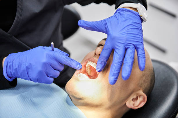 Best Dentist for Severe Toothache  in Buena Vista, VA