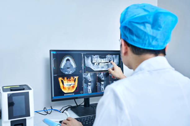 Best Teeth Whitening  in Buena Vista, VA