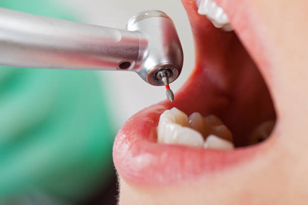 Best Cracked Tooth Emergency Dentist  in Buena Vista, VA
